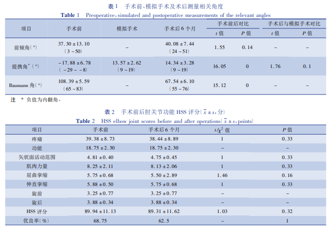 3D 打印技术在小儿后天性肘内翻畸形截骨矫形术中的应用